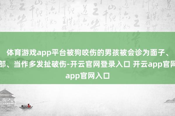 体育游戏app平台被狗咬伤的男孩被会诊为面子、头颈部、当作多发扯破伤-开云官网登录入口 开云app官网入口